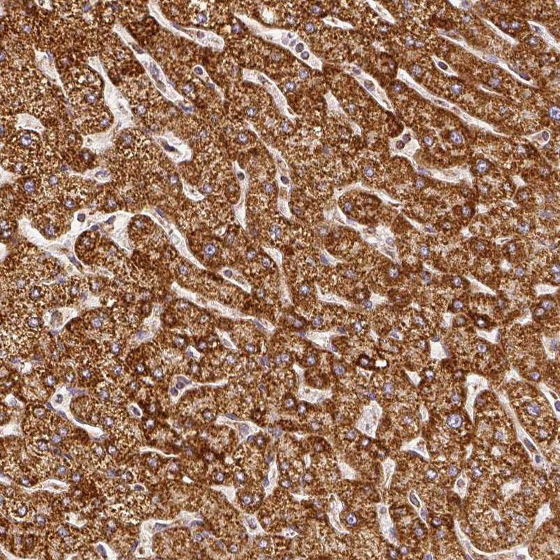 Immunohistochemistry-Paraffin SDHB Antibody - BSA Free