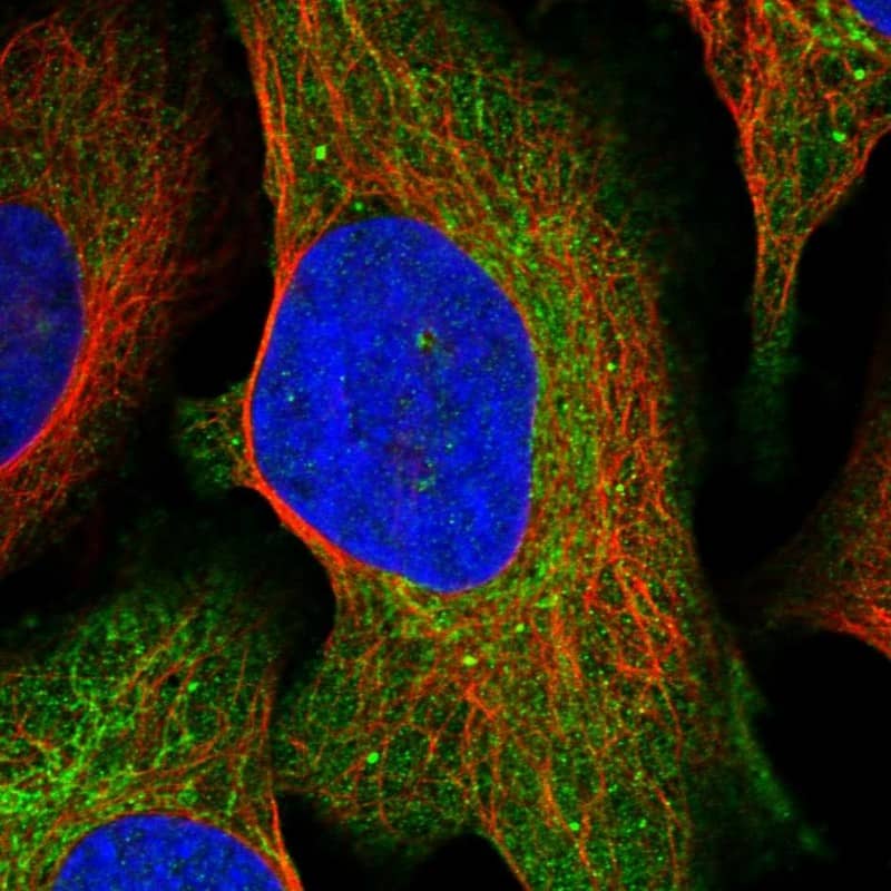 Staining of human cell line U-2 OS shows localization to cytosol & mitochondria.