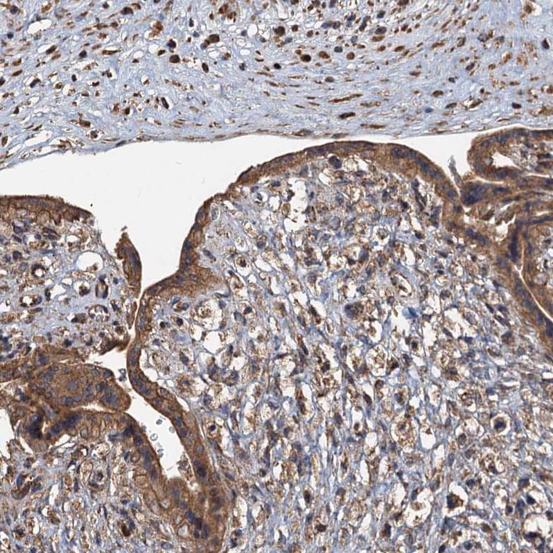 Staining of human placenta shows moderate cytoplasmic positivity in trophoblastic cells.