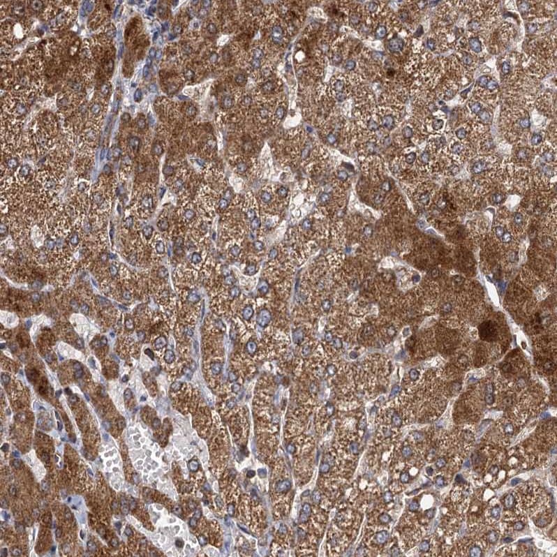 Staining of human liver shows moderate cytoplasmic positivity in hepatocytes.