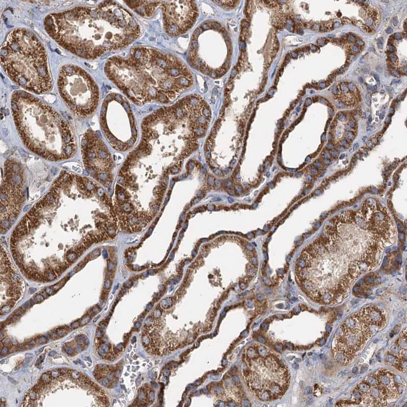 Staining of human kidney shows moderate cytoplasmic-granular positivity in cells in tubules.