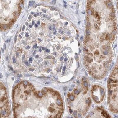 <b>Independent Antibodies Validation. </b>Staining of human kidney.