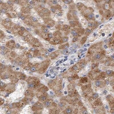 Staining of human liver.