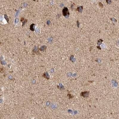 Staining of human cerebral cortex.