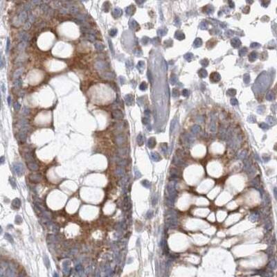 Staining of human colon.