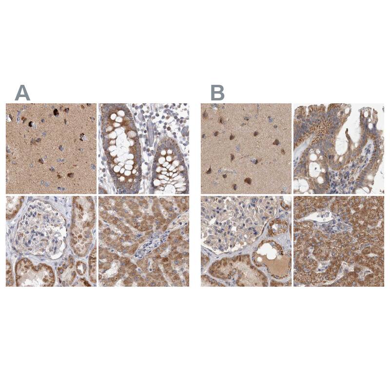 <b>Orthogonal Strategies Validation. </b>Staining of human cerebral cortex, colon, kidney and liver HPA021565 (A) shows similar protein distribution across tissues to independent antibody HPA021579 (B).