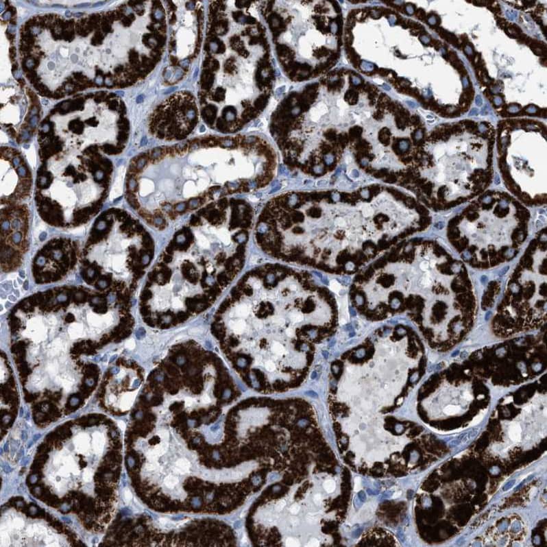 Staining of human kidney shows strong granular cytoplasmic positivity in cells in tubules.