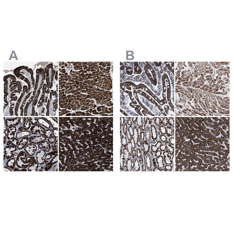 <b>Independent Antibodies Validation. </b>Staining of human gastrointestinal, heart muscle, kidney and liver using Anti-ECHS1 antibody NBP1-87078 (A) shows similar protein distribution across tissues to independent antibody NBP1-87079 (B).