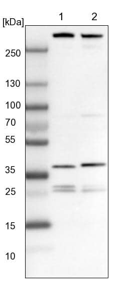 Lane 1: NIH-3T3 cell lysate (Mouse embryonic fibroblast cells)Lane 2: NBT-II cell lysate (Rat Wistar bladder tumour cells)