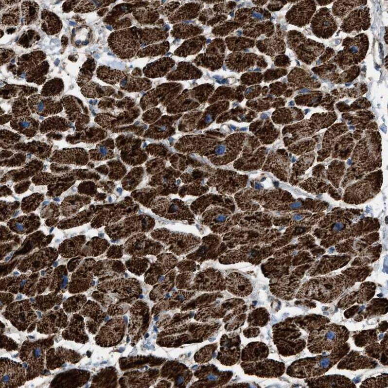 Staining of human heart muscle shows strong granular cytoplasmic positivity in cardiomyocytes.