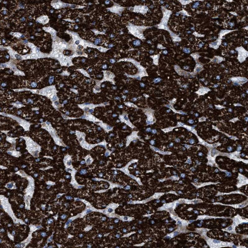 Staining of human liver shows strong granular cytoplasmic positivity in hepatocytes.