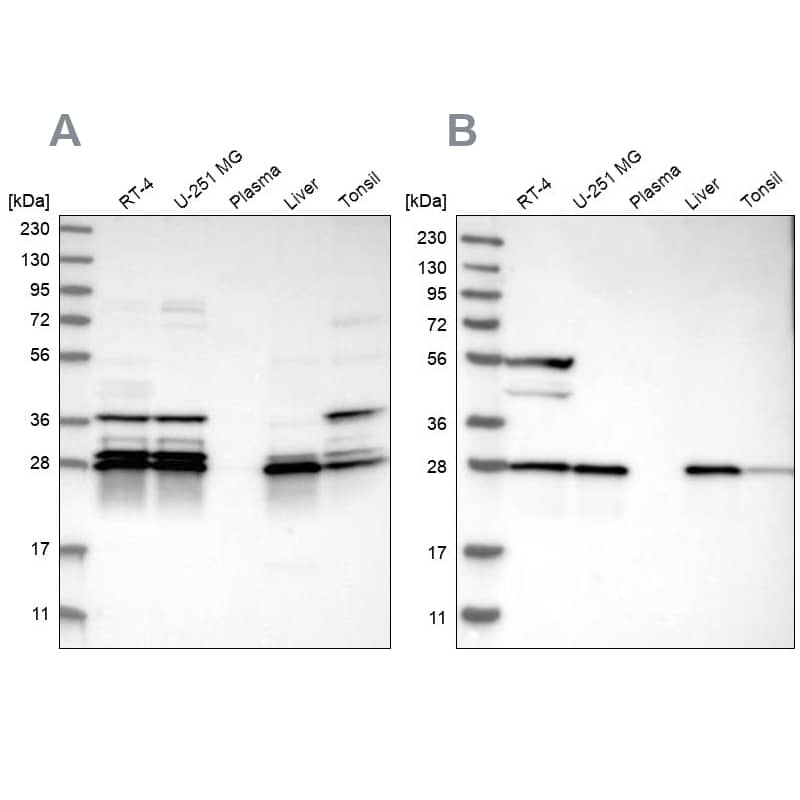 <b>Independent Antibodies Validation. </b>Analysis using Anti-ECHS1 antibody NBP1-87078 (A) shows similar pattern to independent antibody NBP1-87079 (B).