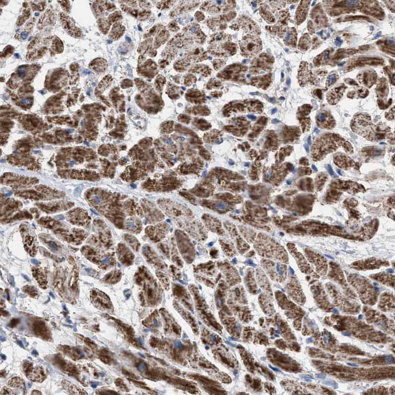 Staining of human heart muscle shows strong granular cytoplasmic positivity in cardiomyocytes.