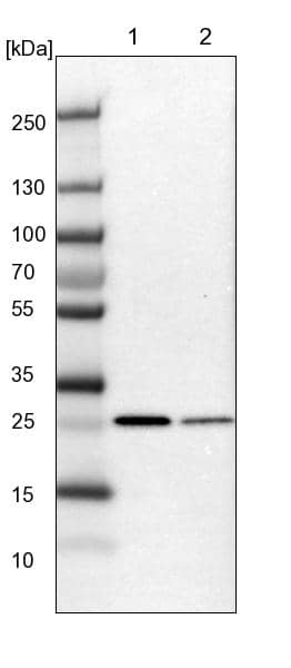 Lane 1: NIH-3T3 cell lysate (Mouse embryonic fibroblast cells)Lane 2: NBT-II cell lysate (Rat Wistar bladder tumour cells)