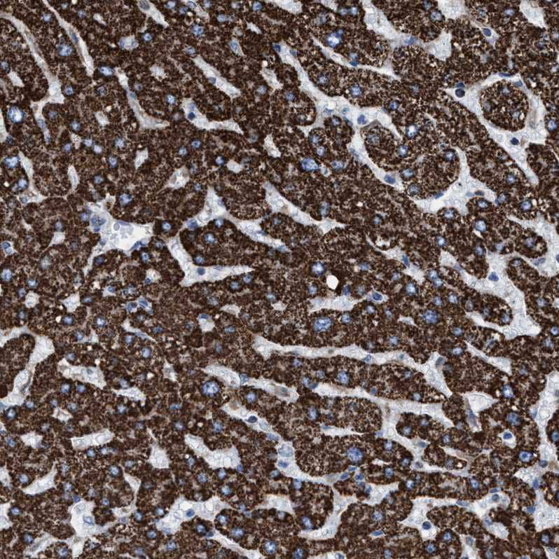 Staining of human liver shows strong granular cytoplasmic positivity in hepatocytes.