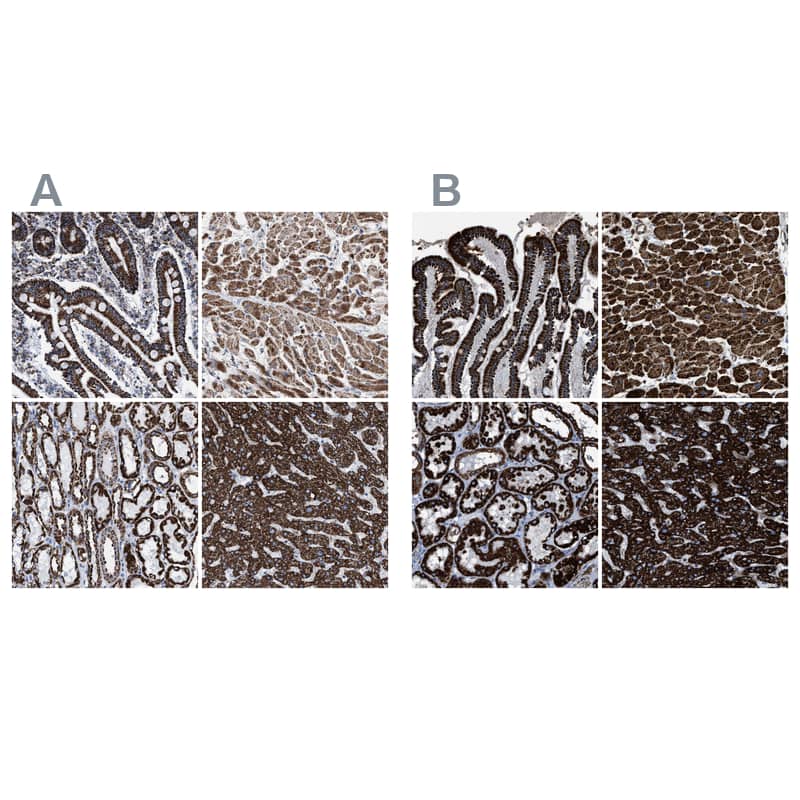 <b>Independent Antibodies Validation. </b>Staining of human gastrointestinal, heart muscle, kidney and liver using Anti-ECHS1 antibody NBP1-87079 (A) shows similar protein distribution across tissues to independent antibody NBP1-87078 (B).