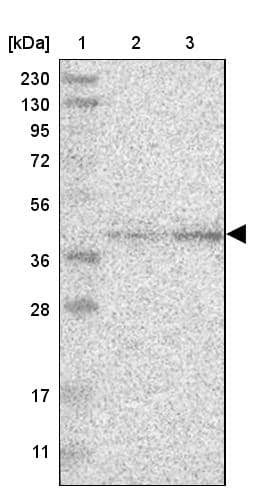 Lane 1: Marker [kDa] 230, 130, 95, 72, 56, 36, 28, 17, 11Lane 2: Human cell line RT-4Lane 3: Human cell line U-251MG sp