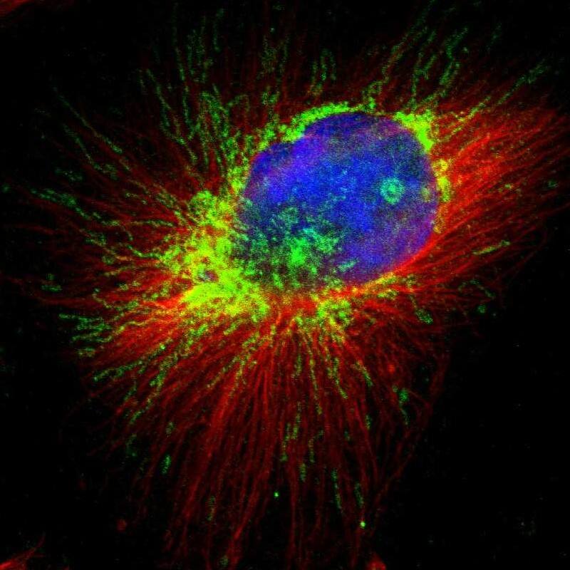 Immunocytochemistry/ Immunofluorescence AFG3L2 Antibody - BSA Free