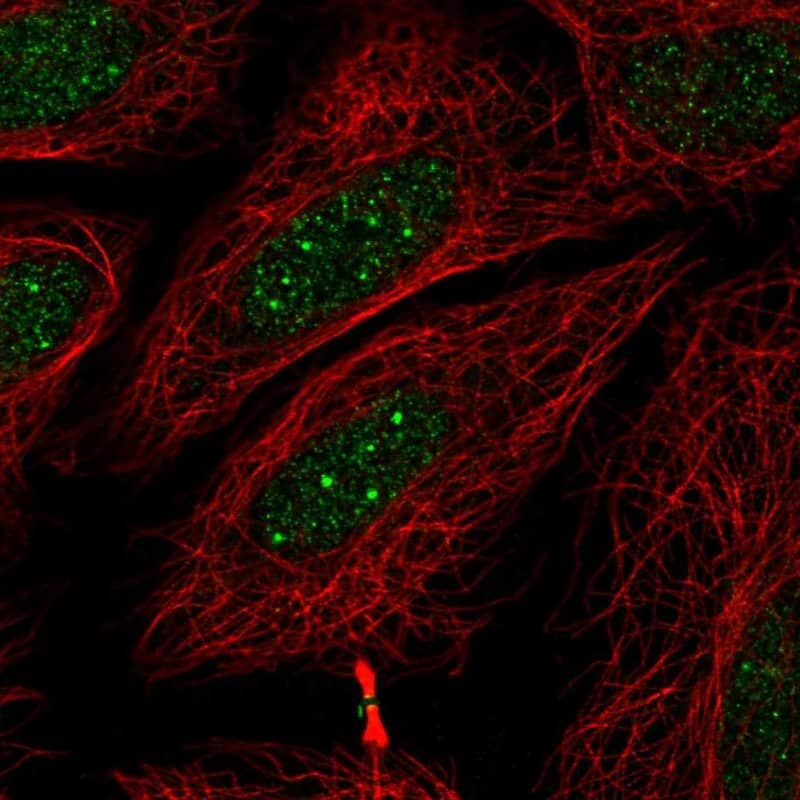 Staining of human cell line SiHa shows localization to nucleus, nuclear bodies & midbody ring.