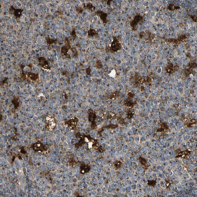 Staining of human lymph node shows strong granular cytoplasmic positivity in germinal center cells.