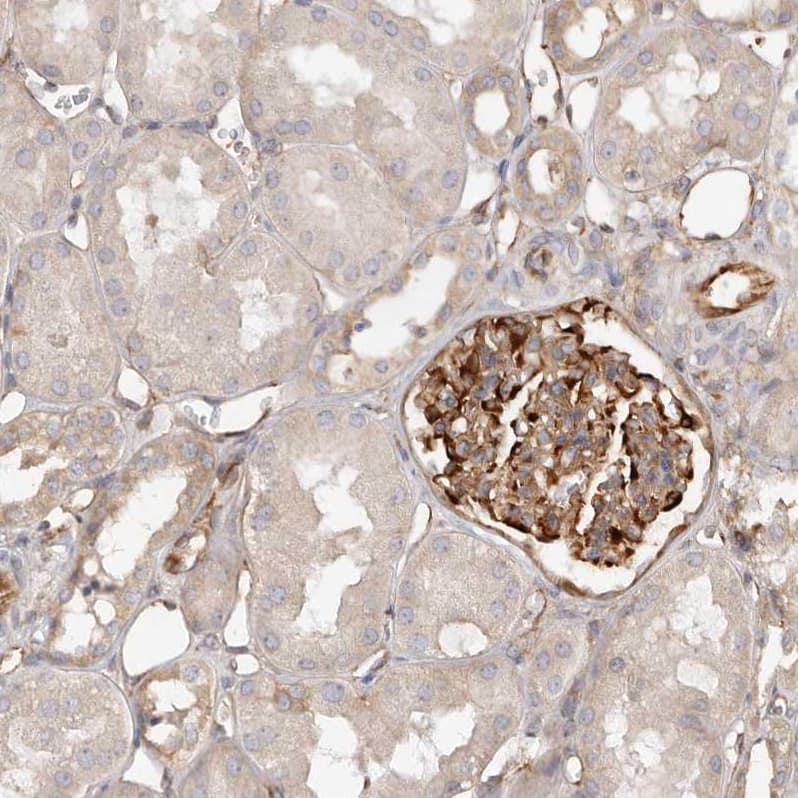 Staining of human kidney shows strong cytoplasmic positivity in cells in glomeruli.