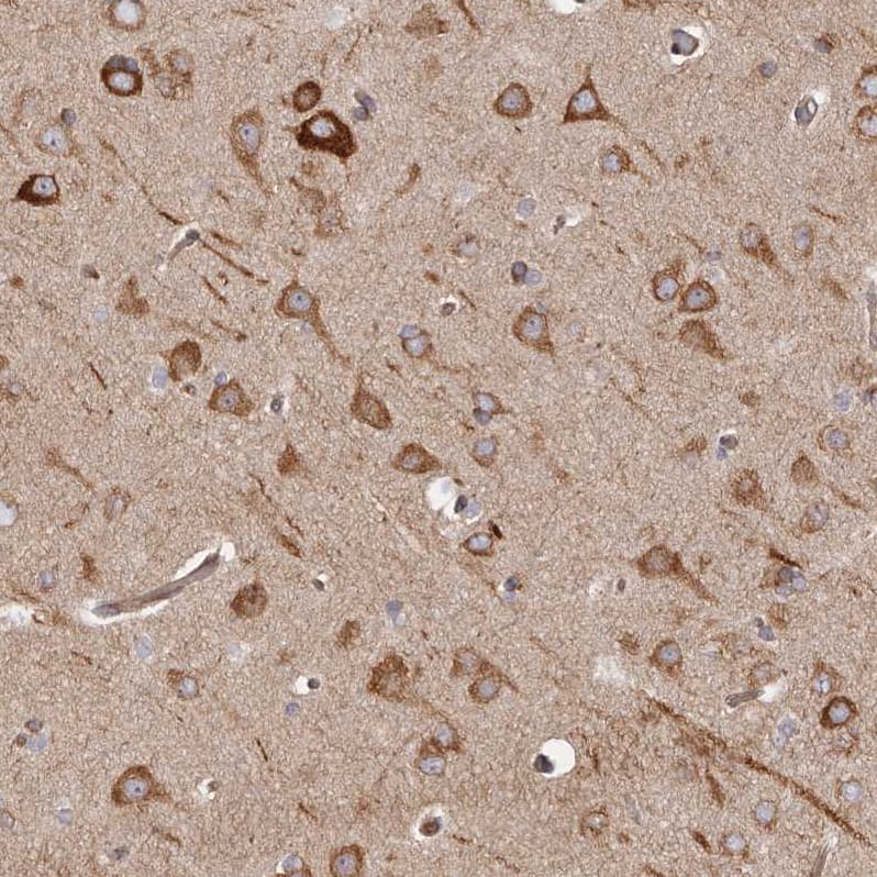 Staining of human cerebral cortex shows strong cytoplasmic positivity in neurons.