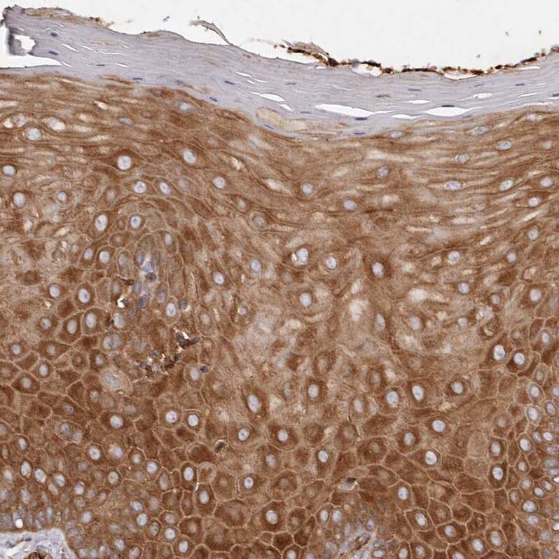 Staining of human cervix shows strong cytoplasmic positivity in squamous epithelial cells.