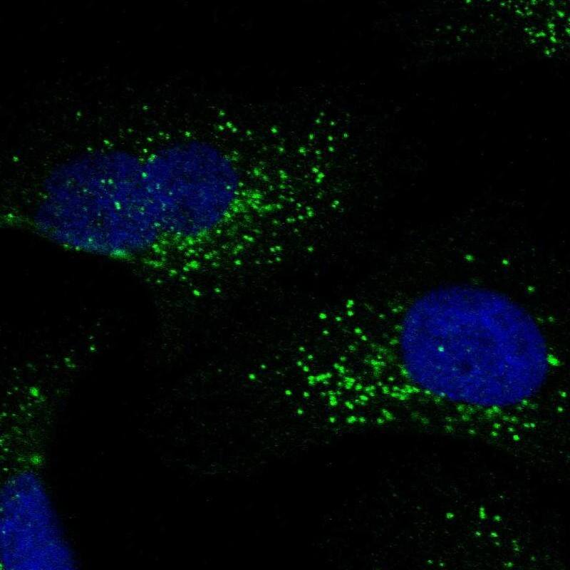 Staining of human cell line U-2 OS shows localization to vesicles.