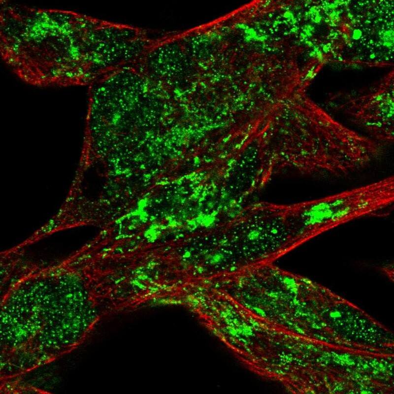 Staining of human cell line RH-30 shows localization to nucleoli fibrillar center & mitochondria.