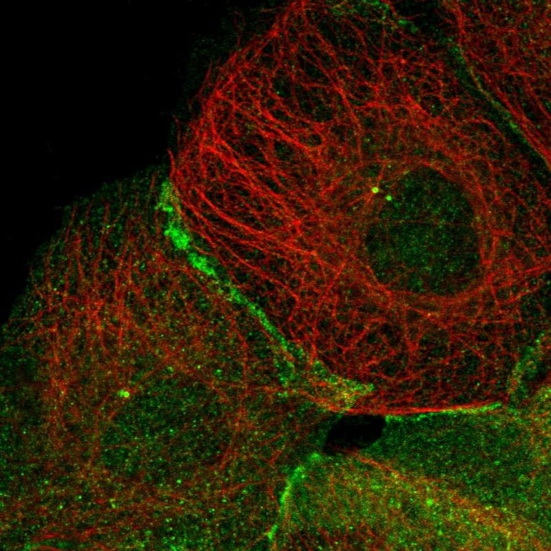 Staining of human cell line A-431 shows localization to plasma membrane, centrosome & cell junctions.