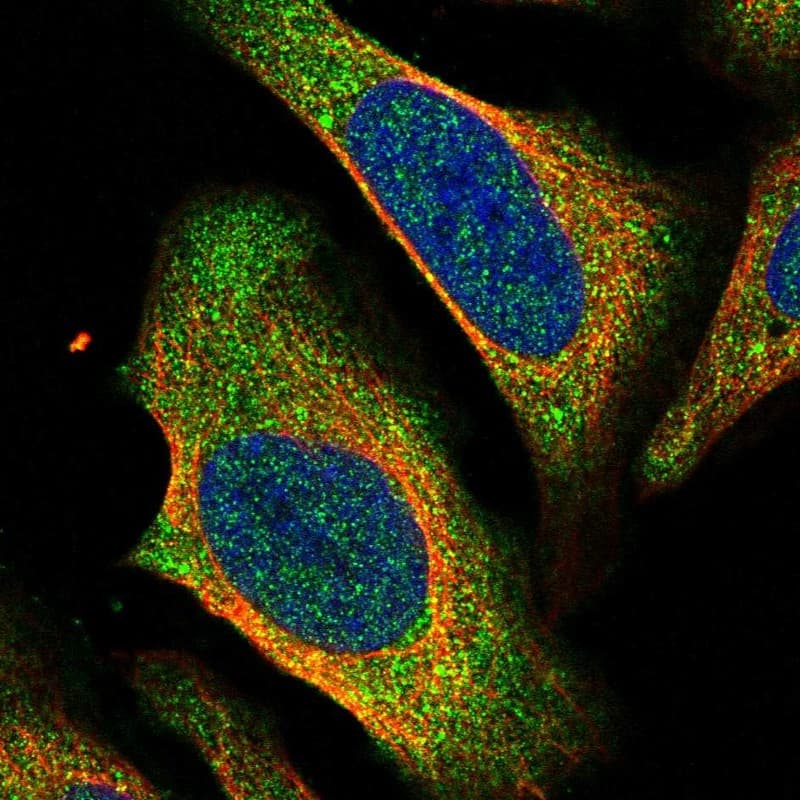 Staining of human cell line U-2 OS shows localization to cytosol.