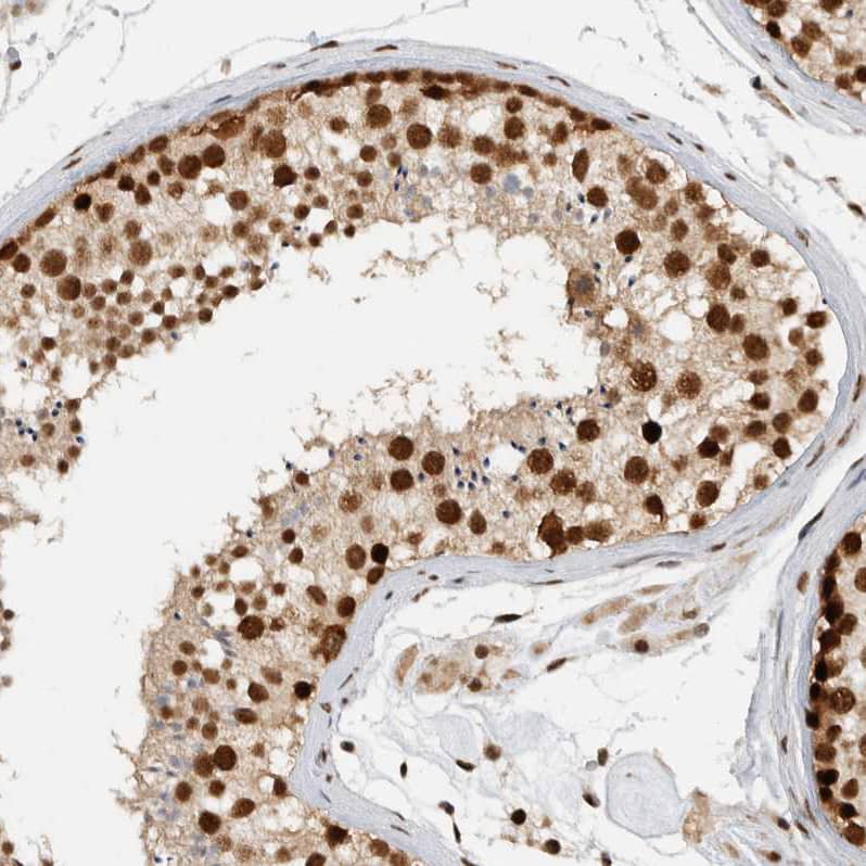 Immunohistochemistry-Paraffin DDX42 Antibody - BSA Free