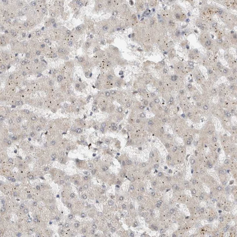 Immunohistochemistry-Paraffin DDX42 Antibody - BSA Free