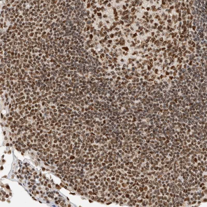 Immunohistochemistry-Paraffin DDX42 Antibody - BSA Free
