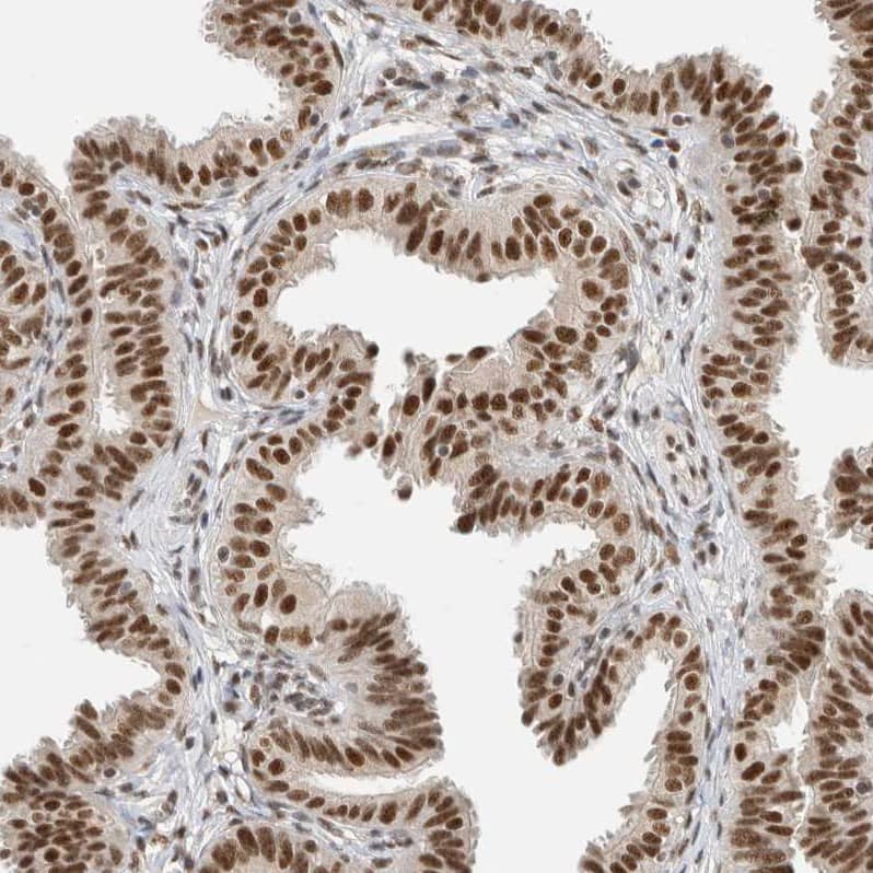 Immunohistochemistry-Paraffin DDX42 Antibody - BSA Free