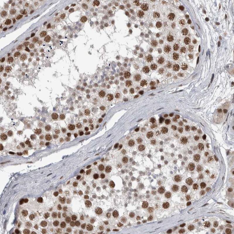 Immunohistochemistry-Paraffin DDX42 Antibody - BSA Free