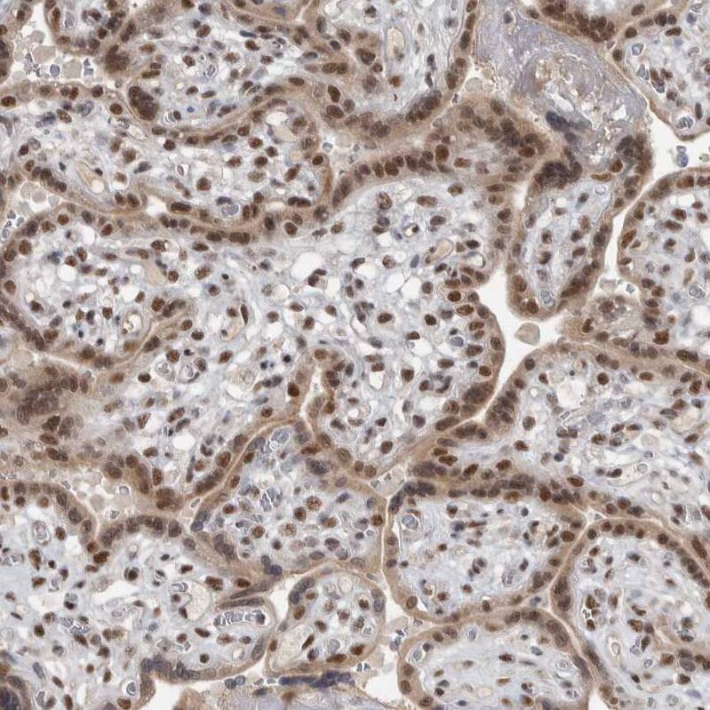 Immunohistochemistry-Paraffin DDX42 Antibody - BSA Free