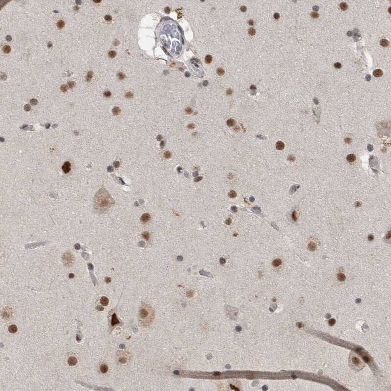 Immunohistochemistry-Paraffin DDX42 Antibody - BSA Free