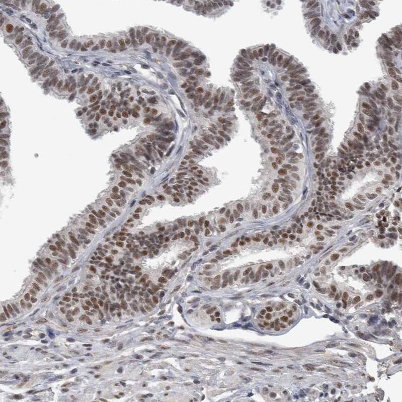 Immunohistochemistry-Paraffin DDX42 Antibody - BSA Free