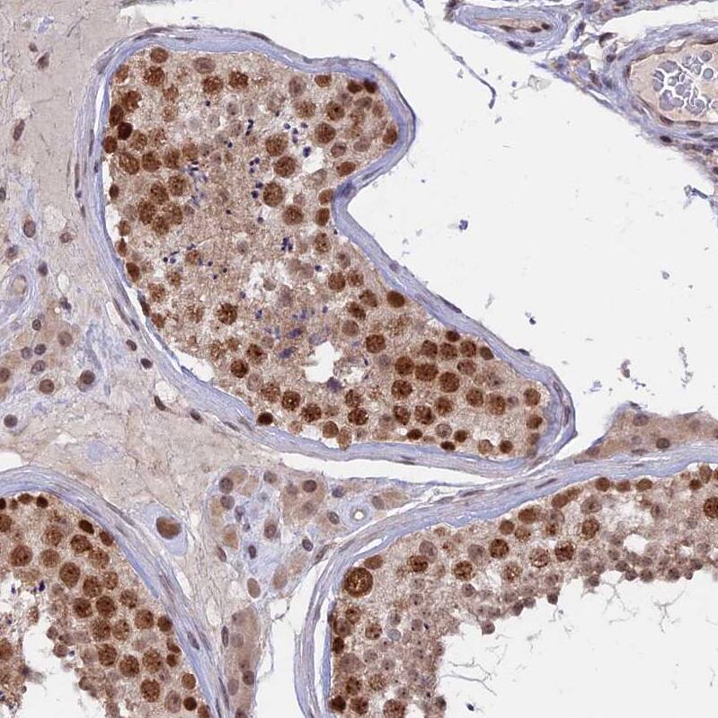 Immunohistochemistry-Paraffin RFC5 Antibody - BSA Free