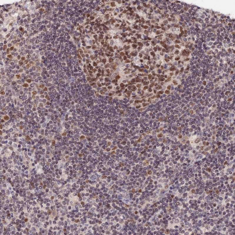 Staining of human lymph node shows moderate nuclear positivity in germinal center cells.