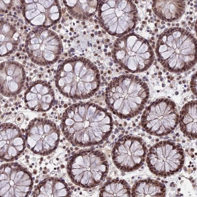 Staining of human colon shows strong nuclear positivity in glandular cells and lymphoid cells.