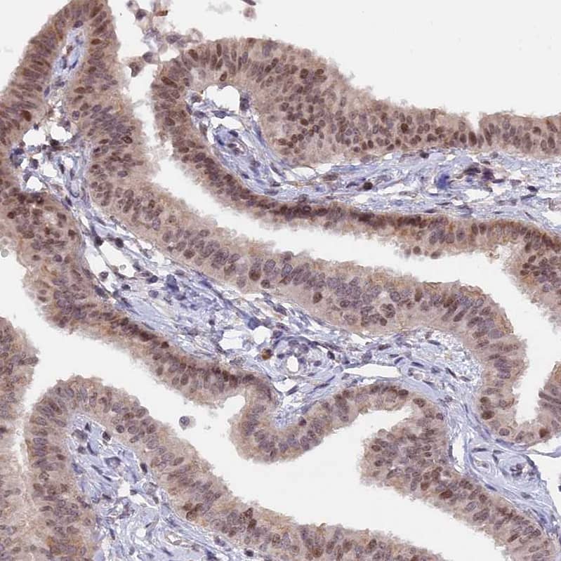 Staining of human fallopian tube shows moderate nuclear positivity in glandular cells.