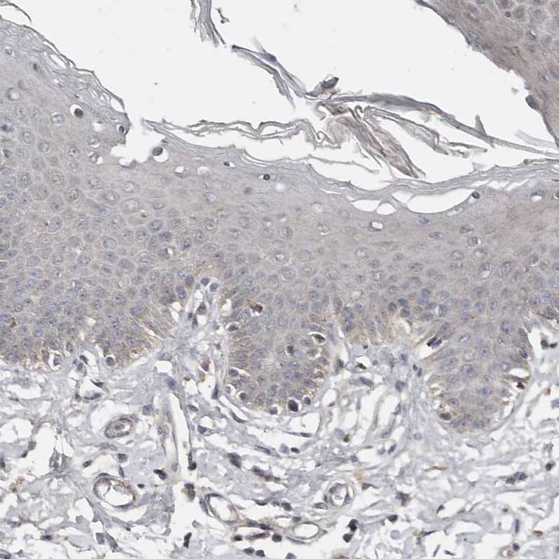 Immunohistochemistry-Paraffin CHML Antibody - BSA Free