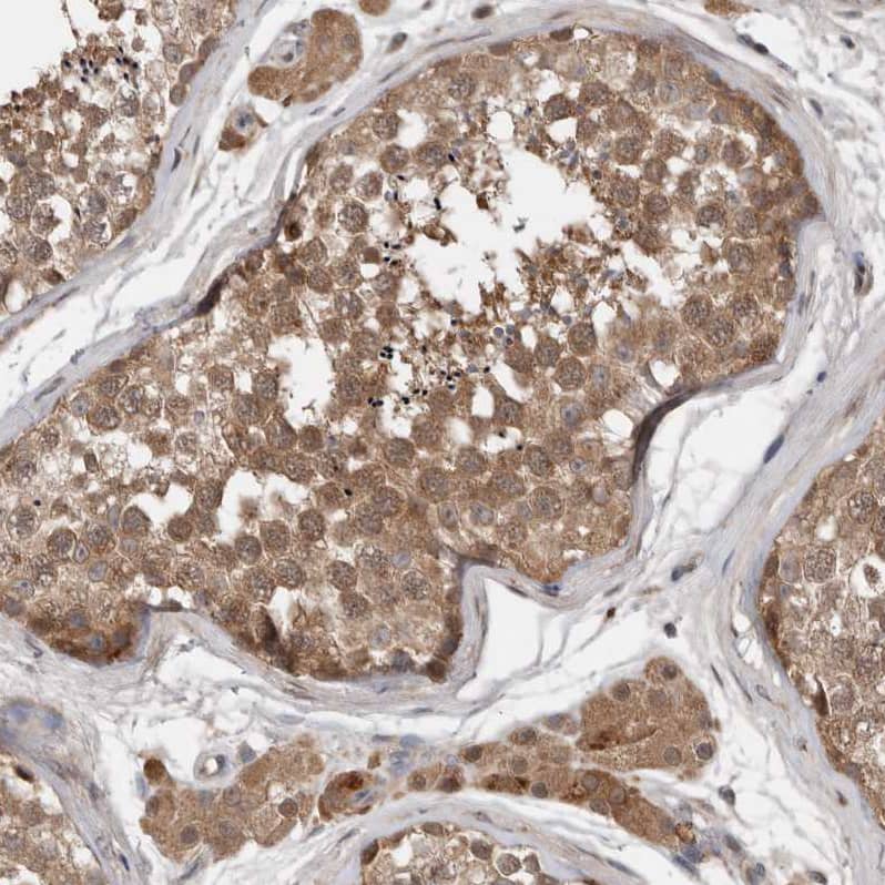 Immunohistochemistry-Paraffin CHML Antibody - BSA Free