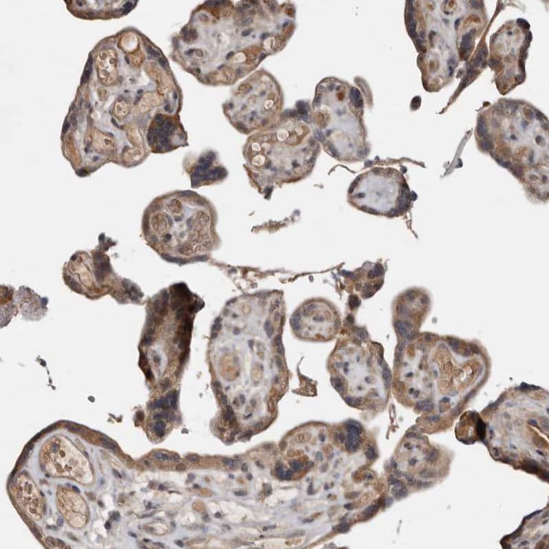 Staining of human Placenta shows moderate cytoplasmic positivity in trophoblastic cells.