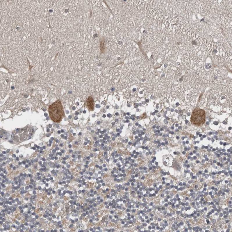 Staining of human Cerebellum shows moderate cytoplasmic positivity in Purkinje cells.