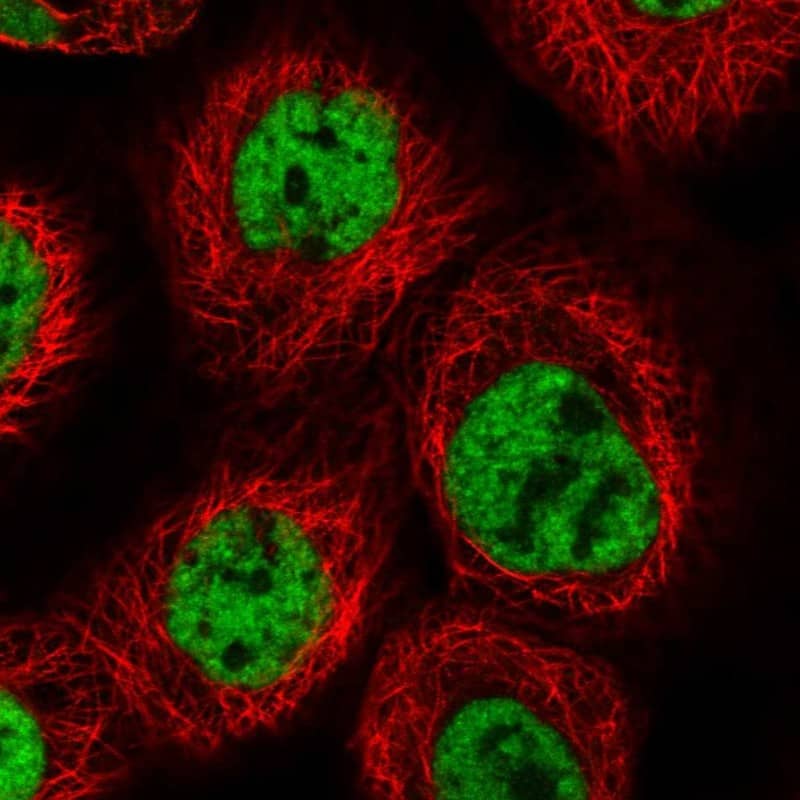 Immunocytochemistry/ Immunofluorescence PRCC Antibody - BSA Free