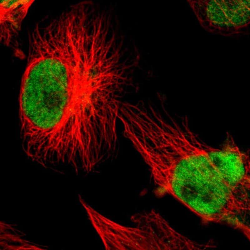 Staining of human cell line U-251 MG shows localization to nucleoplasm.