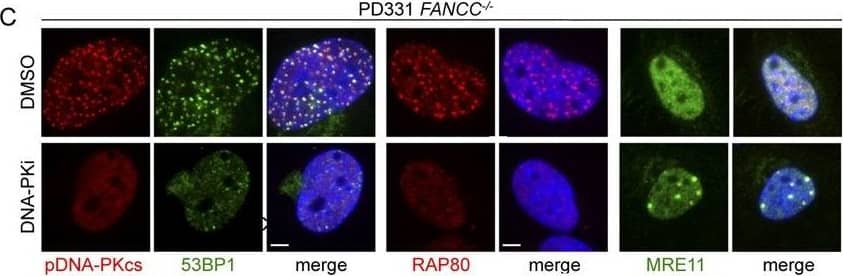 Immunocytochemistry/ Immunofluorescence: RAP80 Antibody [NBP1-87156] - NHEJ pathway inhibition rescue HR & cell survival in FA cells. (A) Representative images of pDNA-PKcs (red) & MRE11 (green) foci in nuclei (DAPI stained, blue) of FANCC-corrected (PD331 corr) or FANCC-mutated (PD331 FANCC−/−) cells in which 53BP1 was depleted by siRNA White line: 2 μm. (B) Histogram presents the frequency of MRE11-positive FANCC−/− cells 48 h after 53BP1 downregulation by siRNA transfection. The presented data are the mean of three independent experiments; error bars indicate S.D. *** indicates P < 0.001 using a Student's t-test. (C) Representative images of pDNA-PKcs (red), 53BP1 (green), RAP80 (red) or MRE11 (green) foci in nuclei (DAPI stained, blue) of FANCC-deficient cells (PD331 FANC−/−) treated with DMSO or with a DNA-PK specific inhibitor. The cells were treated with DNA-PK inhibitor (DNA-PKi 10 μm) for 2 h before MMC exposure (200 ng/ml). White line: 2 μm. (D & E) Clonogenic survival of FANCC-proficient (D, PD331 corr) or -mutated (E, PD331 FANCC−/−) cells after 53BP1 depletion by siRNA and/or DNA-PK inhibition. The cells were treated with MMC at the indicated doses. The presented data are the mean of three independent experiments; error bars indicate S.D. * indicates P < 0.05 using a Student's t-test. Image collected & cropped by CiteAb from the following publication (//pubmed.ncbi.nlm.nih.gov/26446986), licensed under a CC-BY license. Not internally tested by Novus Biologicals.